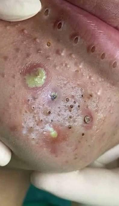 Jack the Giant Slayer